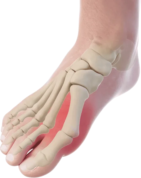 Dr Seng Chusheng, orthopaedic bunion specialist in Singapore